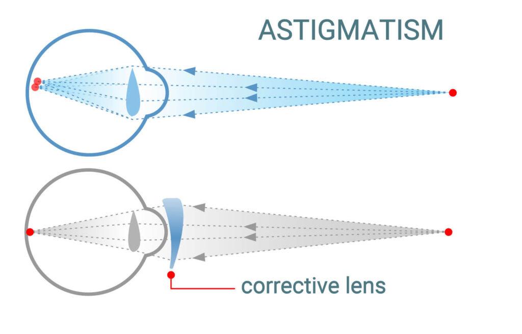 Viewpoint optometrist astigmatism